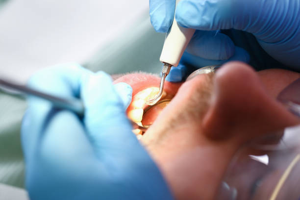 Best Broken Tooth Emergency  in Morton, IL