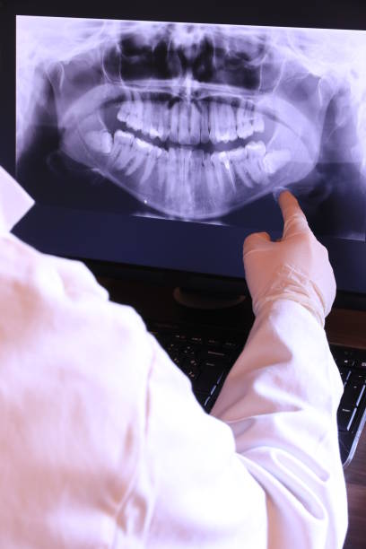 Best Teeth Whitening  in Morton, IL